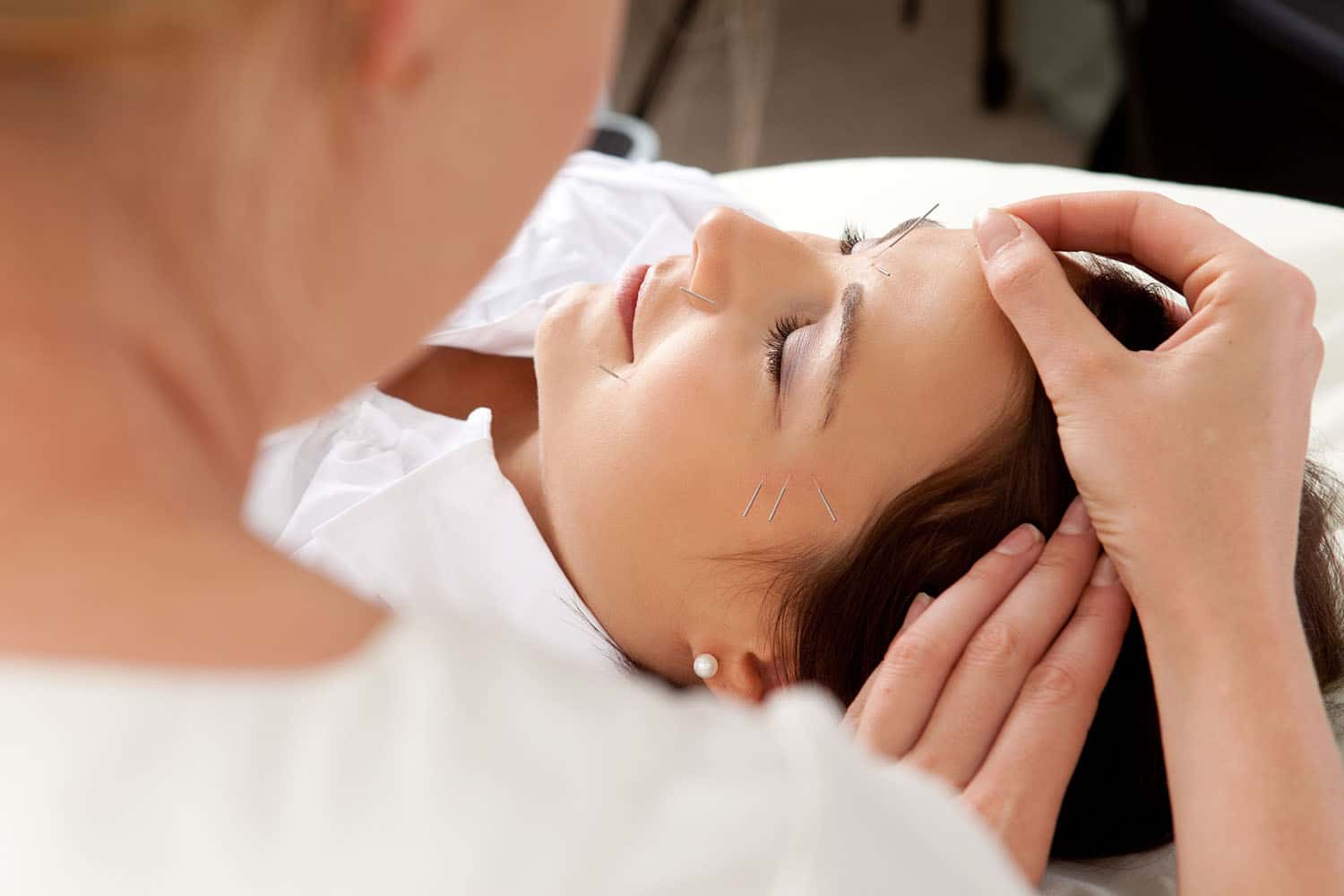 Dr. West putting acupuncture pins in face of woman